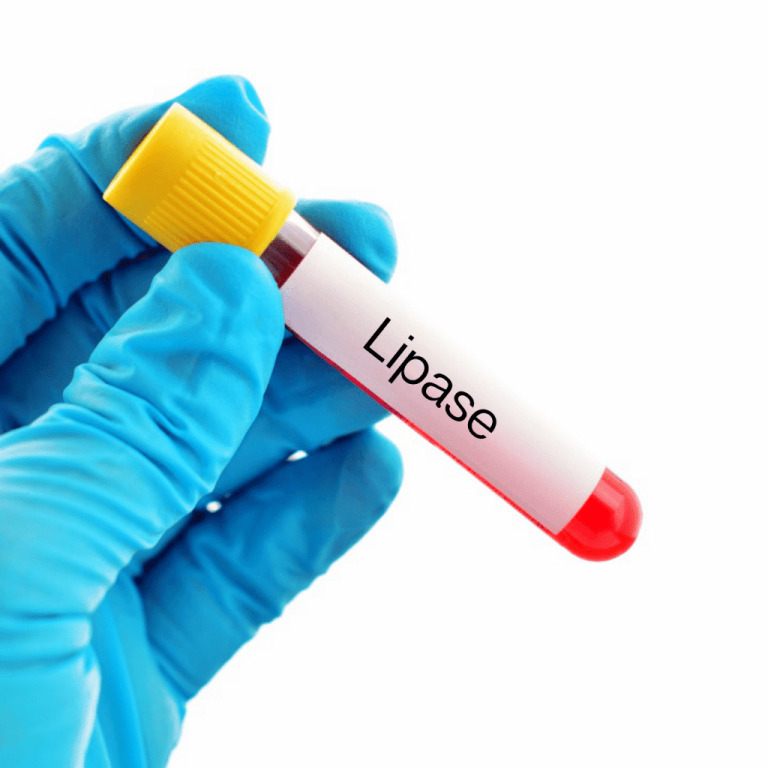 Lipase Lab Test, Blood testing Home Kit £49.99