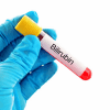 A-bilirubin test at home - Product ID: 118135