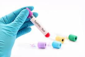 Syphilis home test kit blood test