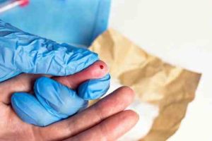 Ureaplasma Test STI testing fertility blood tests