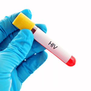 HIV blood home test kit