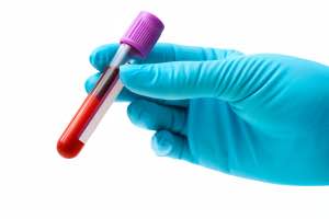 CA125, blood test, ovarian cancer, HPV